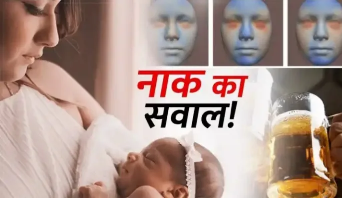 माँ के शराब पीने से बिगड़ा बच्चे का चेहरा मजाक नहीं